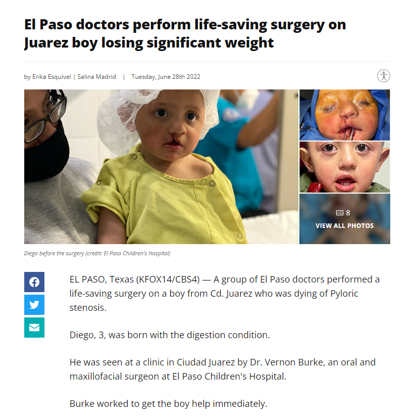 el paso tx news article about dr. vernon burke